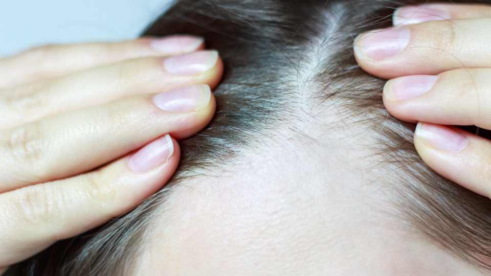 close up of thinning hair